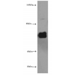 Extracellular Matrix Protein 1 (ECM1) Antibody