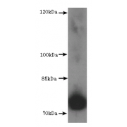 Fidgetin-Like 1 (FIGNL1) Antibody