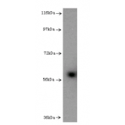 Interleukin 7 Receptor (IL7R) Antibody