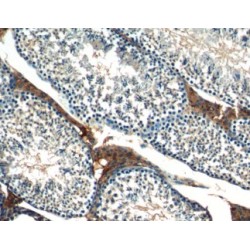 Cell Migration Inducing Hyaluronan Binding Protein / KIAA1199 (CEMIP) Antibody