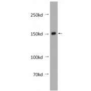 WB analysis of COLO320 cells, using CEMIP antibody (1/600 dilution). Predicted band size: 153 kDa, Observed band size: 150 kDa.