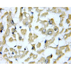 Sarcolipin (SLN) Antibody