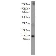 WB analysis of mouse heart tissue subjected to SDS-PAGE, using SLN antibody (1/300 dilution, incubation at room temperature for 1.5 h).
