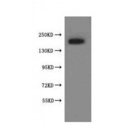 WB analysis of rat testis tissue, using SSFA2/KRAP antibody (1/500 dilution). Predicted band size: 138 kDa.