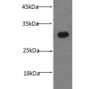 abx116851