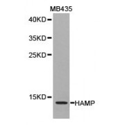 WB analysis of extracts of MB435 cell lines, using Hepcidin 25 (Hepc 25) antibody.