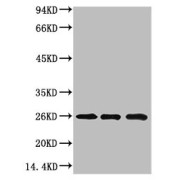 WB analysis of 1) Hela Cell Lysate, 2)3T3 Cell Lysate, 3) PC12 Cell Lysate using Chromobox Protein Homolog 3 (CBX3) Antibody (1/1000 dilution)