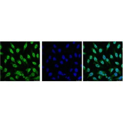 Cellular Tumor Antigen p53 (TP53) Antibody
