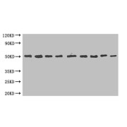 MBP-tagged fusion protein (20 ng/ml) was subjected to SDS-PAGE followed by Western Blot with MBP Antibody at dilution of: </br>Lane 1: 1000</br> Lane 2: 2000</br>Lane 3: 4000</br>Lane 4: 8000</br>Lane 5: 16000</br> Lane 6: 32000</br> Lane 7: 64000</br>Lane 8: 128000</br>Lane 9: 256000</br>Secondary: <br />Goat polyclonal to Mouse IgG at 1/5000 dilution<br />Predicted band size: 50 kDa<br />Observed band size: 50 kDa