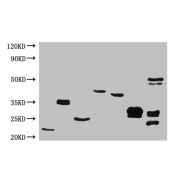 All lanes: Mouse Anti-6*his monoclonal antibody at 1ug/ml<br />Western blot analysis of 6*his Epitope Tag was performde by loadi ng various amounts of lysates containi ng different HIS tagged<br />Recombinant proteins per well onto a 15% Tris-HCL polyacrylamide gel.<br />Line 1: FABP3 insect cell lysate<br />Line 2: TK1 insect cell lysate<br />Line 3: cagA insect cell lysate<br />Line 4: ngAL insect cell lysate<br />Line 5: IGFBP1 293T cell lysate<br />Line 6: TRY2 293T cell lysate