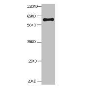 All lanes: Mouse Anti-BSA monoclonal antibody at 1 µg/ml<br /> Lane 1: Bovine serum Albumin<br /> Predicted band size: 67kd<br /> Observed band size: 67kd<br />