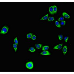 Podocalyxin (PODXL) Antibody