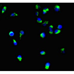 Podocalyxin (PODXL) Antibody