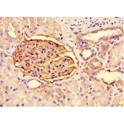 Podocalyxin (PODXL) Antibody