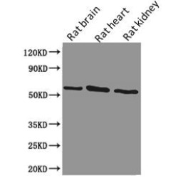 Podocalyxin (PODXL) Antibody
