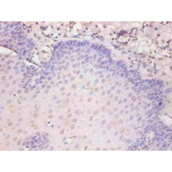 Cytokeratin 19 Fragment Antigen 21-1 (CYFRA21-1) Antibody