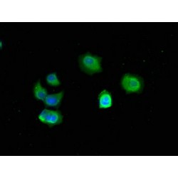 Trefoil Factor 3 (TFF3) Antibody