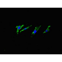 Amyloid-beta Precursor Protein (APP) Antibody