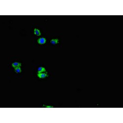 Amyloid-beta Precursor Protein (APP) Antibody