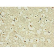 Immunohistochemistry analysis of paraffin-embedded human brain using NPPB Antibody in 30 µg/ml dilute concentrations.