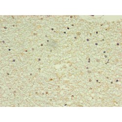 Natriuretic Peptides B (NPPB) Antibody