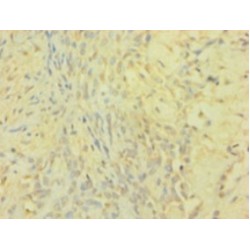 Metalloproteinase Inhibitor 1 (TIMP1) Antibody