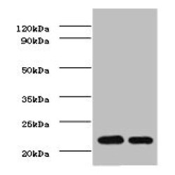 Metalloproteinase Inhibitor 1 (TIMP1) Antibody