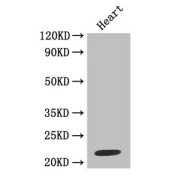 Western blot<br />All lanes: Metalloproteinase inhibitor 1 antibody at 2 µg/ml</br>Lane 1: Jurkat whole cell lysate</br>Lane 2: MCF-7 whole cell lysate</br>Secondary</br>Goat polyclonal to rabbit at 1/10000 dilution</br>Predicted band size: 23 kDa</br>Observed band size: 23 kDa</br>.