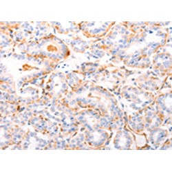 Retinal-Specific ATP-Binding Cassette Transporter (ABCA4) Antibody