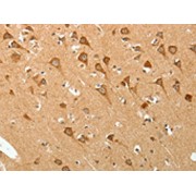 IHC-P analysis of Human brain tissue, using PGBD5 antibody (1/20 dilution, 200X magnification).