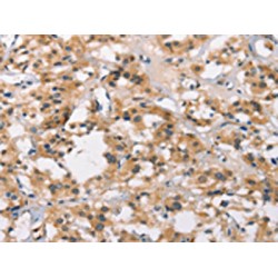 Mitochondrial Amidoxime-Reducing Component 1 (MTARC1) Antibody
