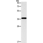 WB analysis of HepG2 cells, using MTARC1 antibody (1/1400 dilution). Exposure time: 40 seconds.