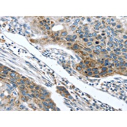 Transmembrane Protease, Serine 5 (TMPRSS5) Antibody