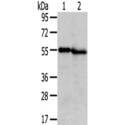 WB analysis of Human liver (1) and kidney (2) tissue lysates (40 µg per lane), using TMPRSS5 antibody (1/300 dilution) followed by a Goat anti-Rabbit IgG antibody (1/8000 dilution).