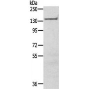 WB analysis of human urinary bladder tissue lysates (40 µg), using SASH1 antibody (1/200 dilution), and goat anti-rabbit IgG (1/8000 dilution). Exposure time: 5 seconds.