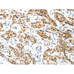 Mitogen-Activated Protein Kinase Kinase Kinase 14 (MAP3K14) Antibody