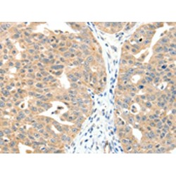 Mitogen-Activated Protein Kinase Kinase Kinase 14 (MAP3K14) Antibody