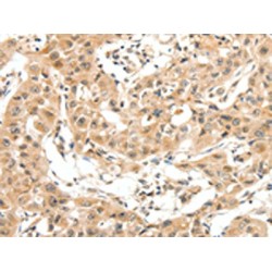 Mitogen-Activated Protein Kinase Kinase Kinase 14 (MAP3K14) Antibody
