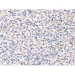 Receptor Tyrosine Kinase Like Orphan Receptor 1 (ROR1) Antibody