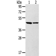 WB analysis (8% SDS-PAGE, 40 µg lysate/lane) of (1) Mouse Brain Tissue, and (2) Mouse Liver Tissue, using LTB4R2 antibody (1/250 dilution) and goat anti-rabbit IgG (1/8000 dilution). Exposure time: 10 seconds.
