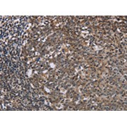 Immunohistochemistry analysis of paraffin-embedded Human tonsil tissue using TBX5 Antibody at dilution 1/20.