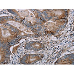 T-Box protein 5 (TBX5) Antibody