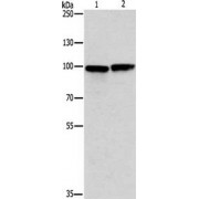 Western blot analysis (6% SDS-PAGE, 40 µg lysate) of (1) Human Testis Tissue, and (2) U937 cells, using MSH5 Antibody (1/200 dilution) and goat anti-rabbit IgG secondary antibody (1/8000 dilution). Exposure time: 5 seconds.