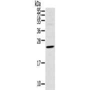 WB analysis of Human fetal brain lysate (40 µg), using TSPAN13 antibody (1/550 dilution) with Goat anti-Rabbit IgG antibody (1/8000 dilution).