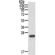 WB analysis of human fetal brain tissue, using RAC1 antibody (1/500 dilution).