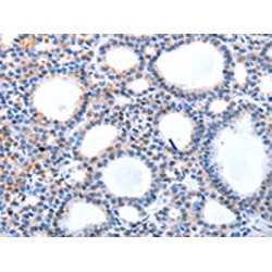 Potassium/Sodium Hyperpolarization-Activated Cyclic Nucleotide-Gated Channel 1 (HCN1) Antibody