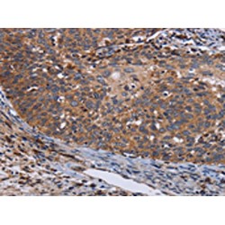 Leucine-Rich Repeat-Containing Protein 15 (LRRC15) Antibody