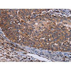 Leucine-Rich Repeat-Containing Protein 15 (LRRC15) Antibody