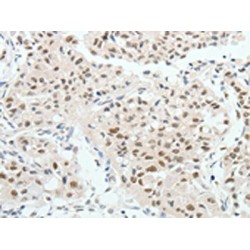 Hepatocyte Nuclear Factor 1 Beta (HNF1B) Antibody
