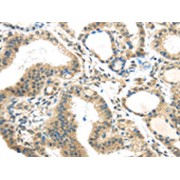 abx241360